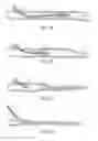 Fig. 04 - ENDOVASCULAR PLASMA TREATMENT DEVICE AND METHOD OF USE