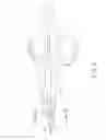 Fig. 03 - Bipolar electrosurgical hand shears