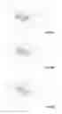 Fig. 09 - Expansion screw for orthodontics