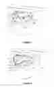 Fig. 02 - Dental framework and prosthesis