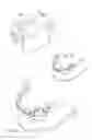 Fig. 02 - Removable dental prosthesis and method of manufacturing said removable dental prosthesis