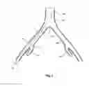 Fig. 02 - Introducer for a side branch device