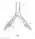 Fig. 05 - Introducer for a side branch device