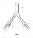Fig. 06 - Introducer for a side branch device