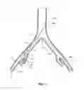 Fig. 10 - Introducer for a side branch device