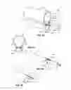 Fig. 11 - Introducer for a side branch device