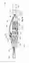 Fig. 13 - Introducer for a side branch device