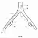 Fig. 02 - Introducer for a side branch device