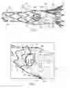 Fig. 04 - Prosthesis having pivoting fenestration