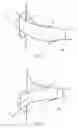 Fig. 09 - Prosthesis having pivoting fenestration