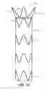 Fig. 07 - Controlled tip release stent graft delivery system and method