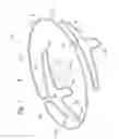 Fig. 02 - Docking station for heart valve prosthesis