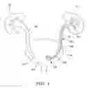 Fig. 02 - Stent pusher assembly