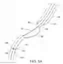 Fig. 08 - Stent pusher assembly