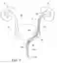 Fig. 09 - Stent pusher assembly