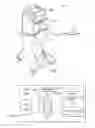 Fig. 02 - Vitrectomy probe with rotary cutter and associated devices, systems, and methods