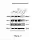 Fig. 11 - Method of treating colorectal cancers using a PKC inhibitor
