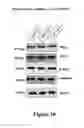 Fig. 13 - Method of treating colorectal cancers using a PKC inhibitor