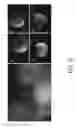 Fig. 07 - Treatment for Chitin-Containing Microorganisms