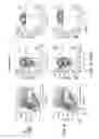 Fig. 07 - NATURAL KILLER CELLS AND USES THEREOF