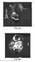 Fig. 09 - NATURAL KILLER CELLS AND USES THEREOF