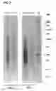 Fig. 03 - PROBIOTIC FOR INFANTILE COLIC