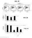 Fig. 08 - Treatment of right ventricular dysfunction due to pressure overload