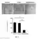 Fig. 04 - USE OF GENETICALLY ENGINEERED STRAIN VNP20009-M IN PREVENTING AND TREATING CANCER METASTASIS