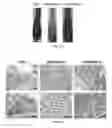 Fig. 08 - USE OF GENETICALLY ENGINEERED STRAIN VNP20009-M IN PREVENTING AND TREATING CANCER METASTASIS