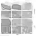 Fig. 09 - USE OF GENETICALLY ENGINEERED STRAIN VNP20009-M IN PREVENTING AND TREATING CANCER METASTASIS