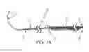 Fig. 08 - Surgical sutures incorporated with stem cells or other bioactive materials