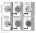 Fig. 01 - Coated vaso-occlusive device and methods for treatment of aneurysms
