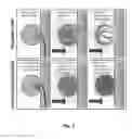 Fig. 02 - Coated vaso-occlusive device and methods for treatment of aneurysms