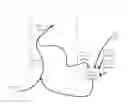 Fig. 01 - METHOD AND APPARATUS FOR MITIGATING ACUTE REOXYGENATION INJURY DURING PERCUTANEOUS CORONARY INTERVENTION