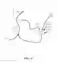 Fig. 05 - METHOD AND APPARATUS FOR MITIGATING ACUTE REOXYGENATION INJURY DURING PERCUTANEOUS CORONARY INTERVENTION