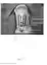 Fig. 02 - Cricotherotomy apparatus and method