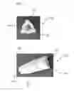 Fig. 02 - READY-TO-USE DEVICE FOR MOUSE BONE MARROW CELLS ISOLATION
