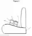 Fig. 02 - Vehicle tray