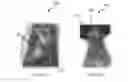 Fig. 10 - A seamless Unibody Structure of a C-Pillar for vehicles