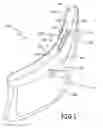 Fig. 02 - Mud guard