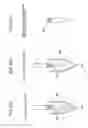 Fig. 02 - Method of removing foreign matter from preform and apparatus for removing foreign matter from preform