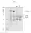 Fig. 07 - Immunogenic bacterial vesicles with outer membrane proteins