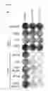 Fig. 02 - Therapeutic targeting of SET1B/compass pathway for treating cancers