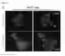 Fig. 49 - Therapeutic targeting of SET1B/compass pathway for treating cancers