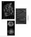 Fig. 04 - Hydrogel Comprising A Scaffold Macromer Crosslinked With A Peptide And A Recognition Motif