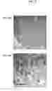 Fig. 09 - Cells genetically modified to comprise pancreatic islet glucokinase and uses thereof