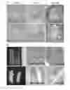 Fig. 01 - Method of identifying and treating a person having a predisposition to or afflicted with a cardiometabolic disease