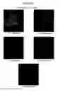 Fig. 02 - PNA probes, probe sets, methods and kits pertaining to the detection of candida