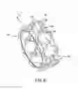 Fig. 07 - Bearing retainer, bearing and associated method