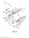 Fig. 08 - Bearing lock, bearing assembly and associated method